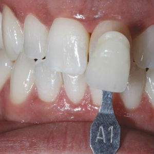beautiful-smile-and-white-teeth